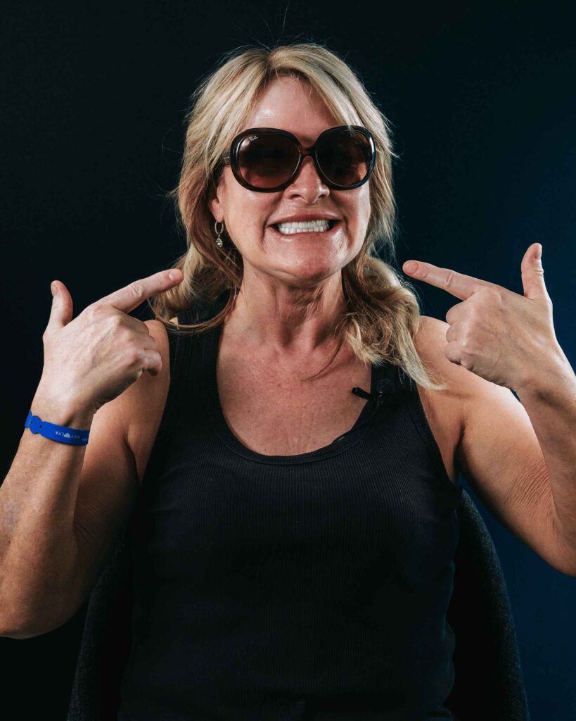 emax laminate veneers