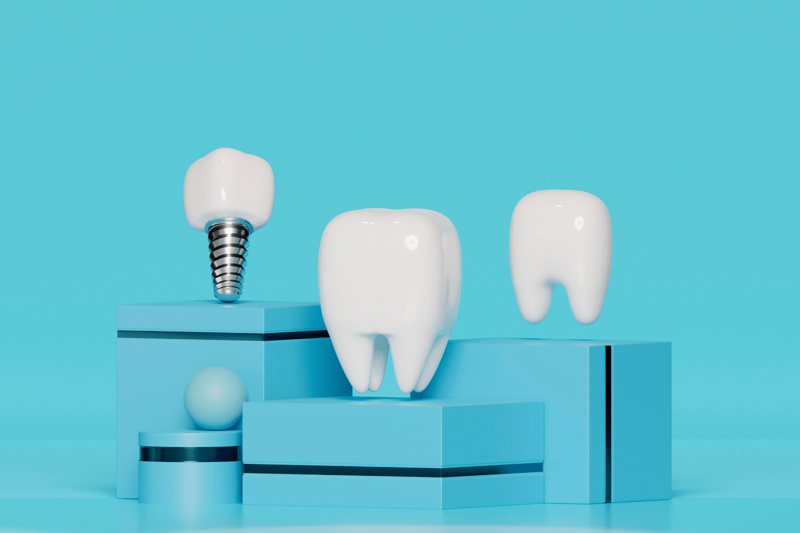 All-on-4 Dental Implants
