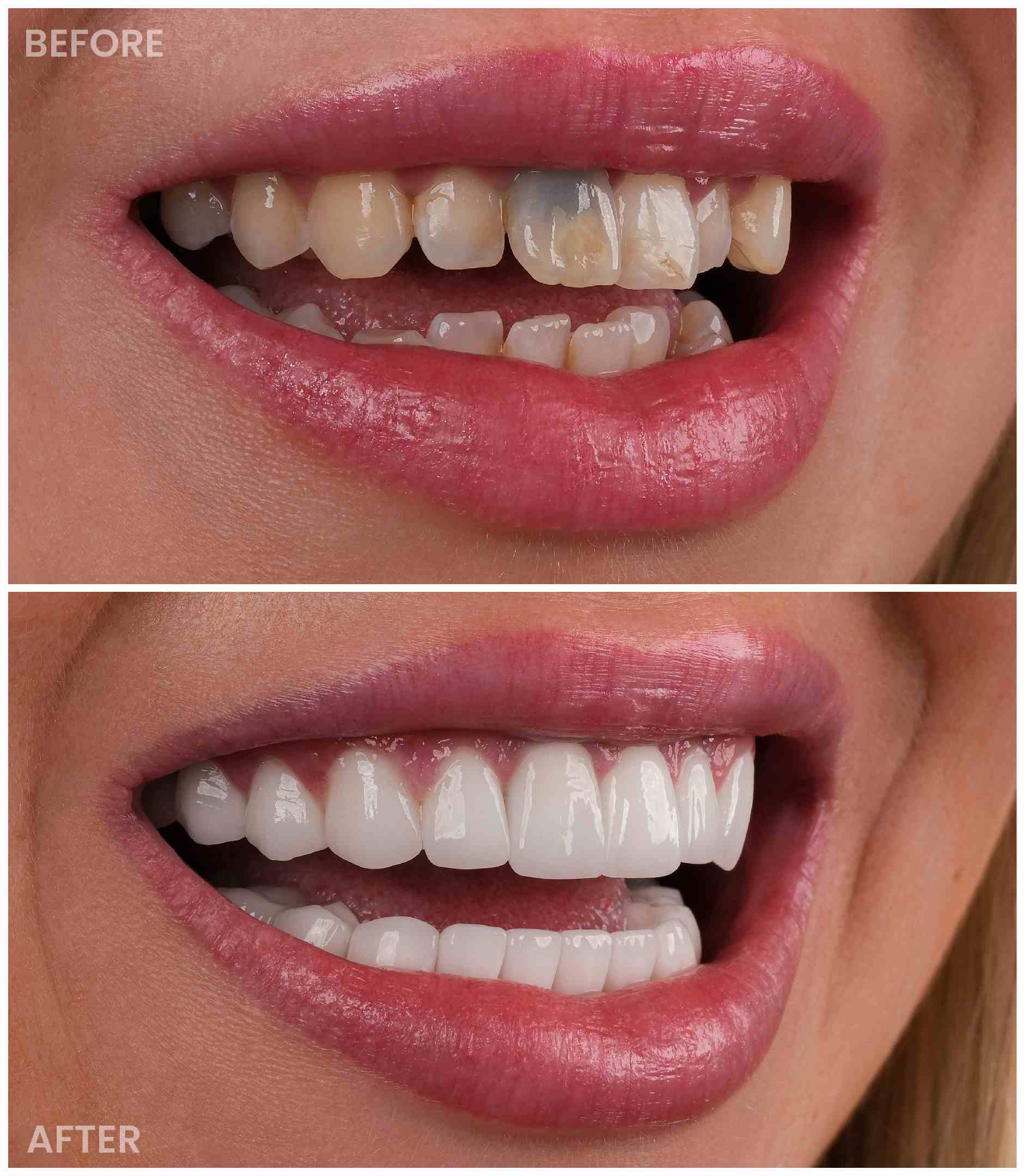 dentist before after