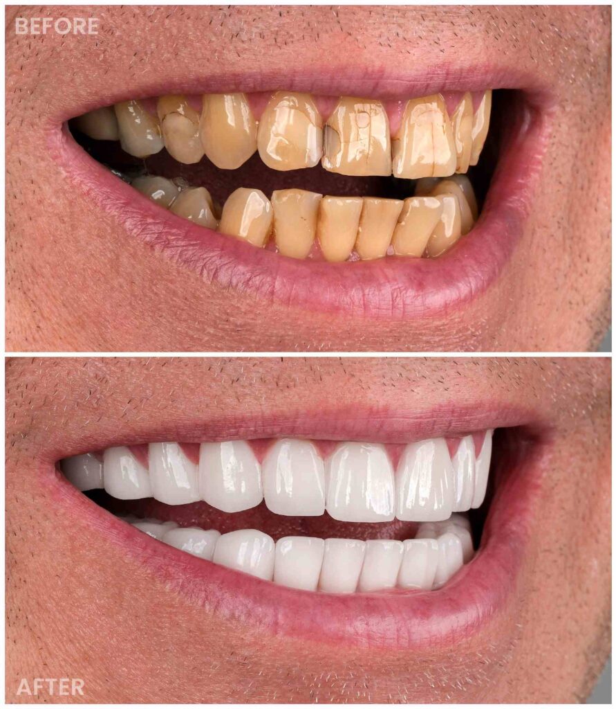 dentist before after