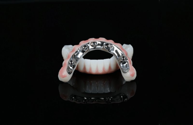 All-on-4 Dental Implants
