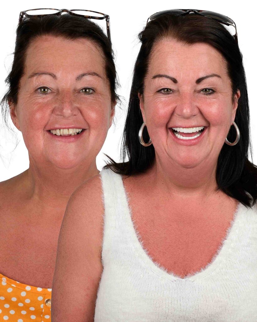 Before & After Gallery