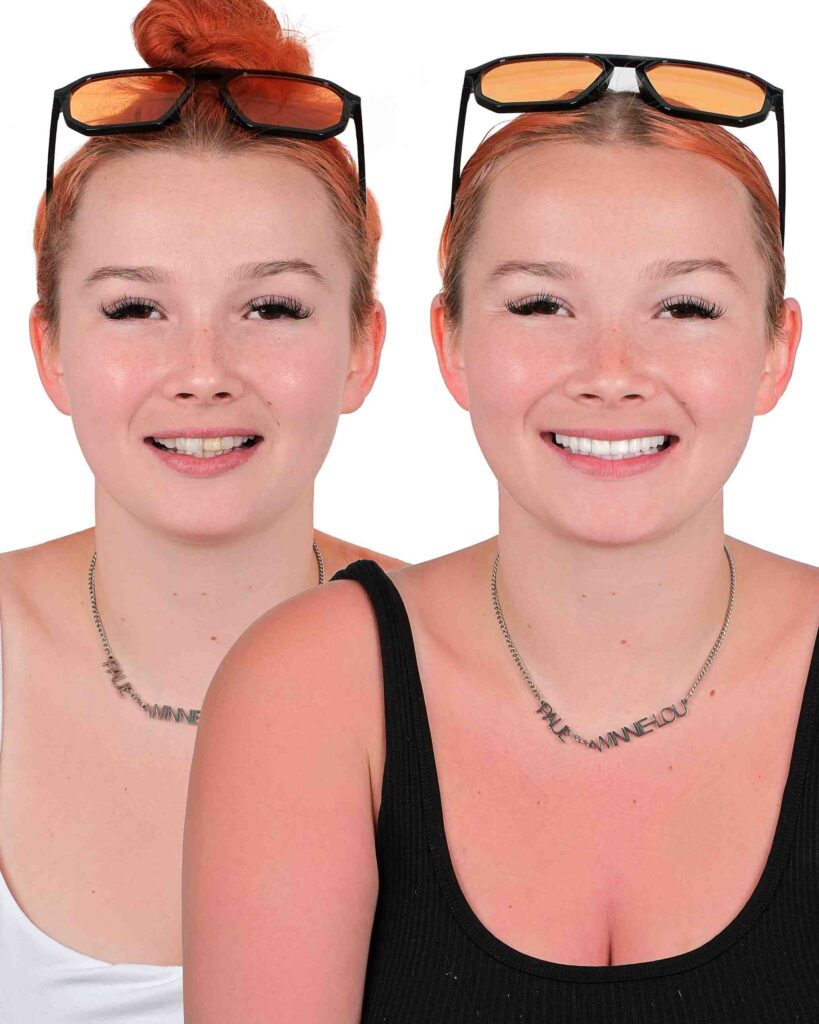 Before & After Gallery