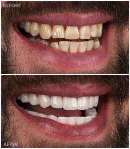 dentist before after