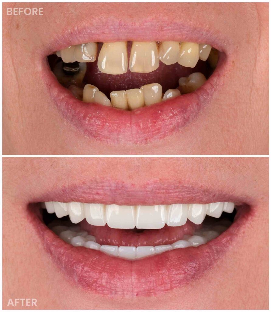 dentist before after