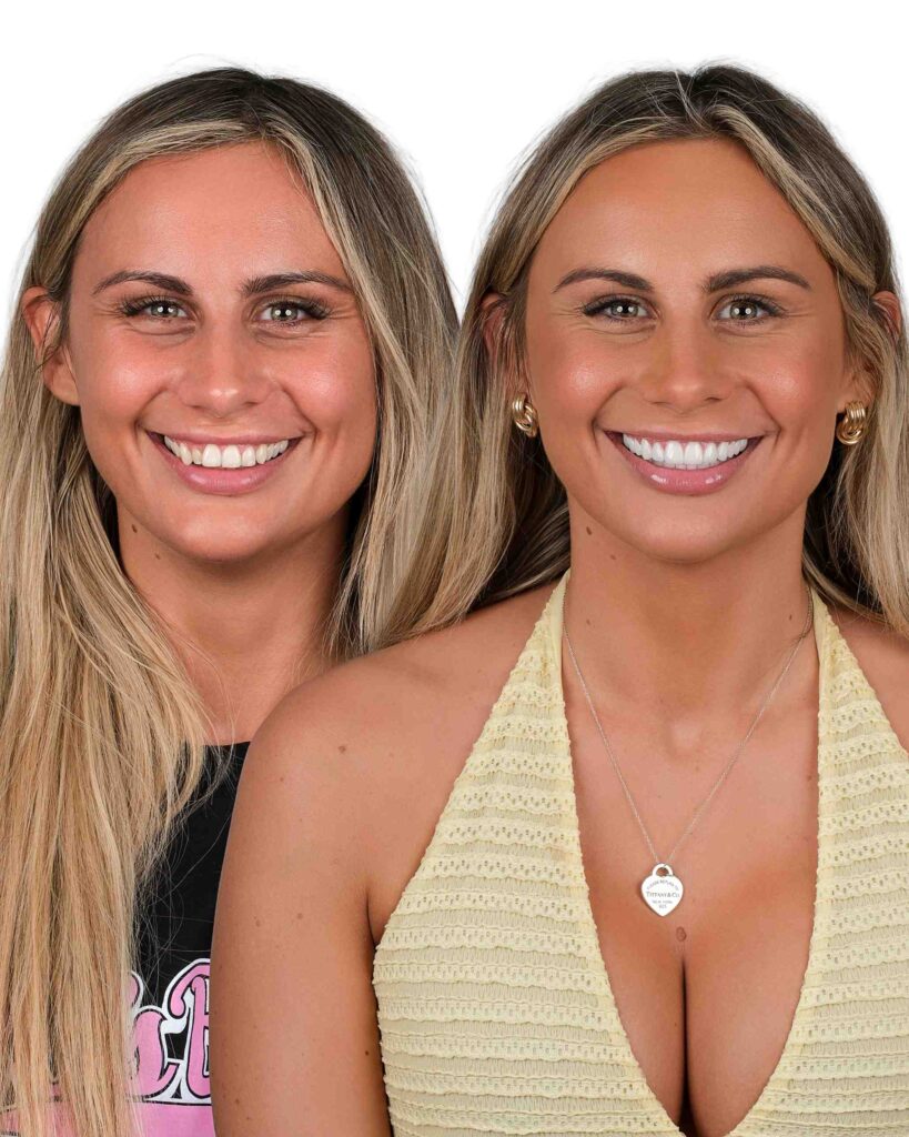 Before & After Gallery