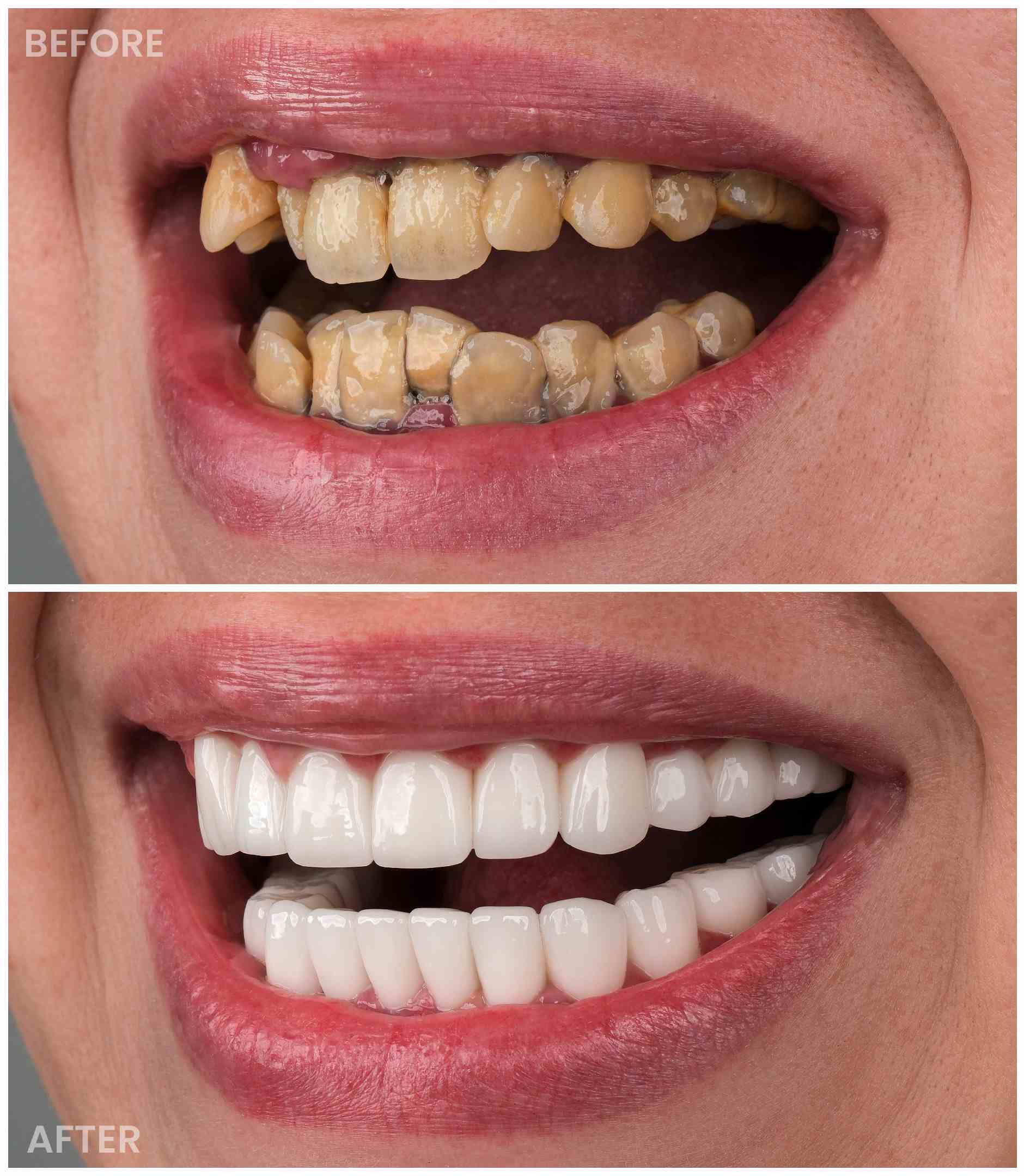 dentist before after