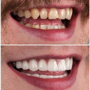 dentist before after dentist before after