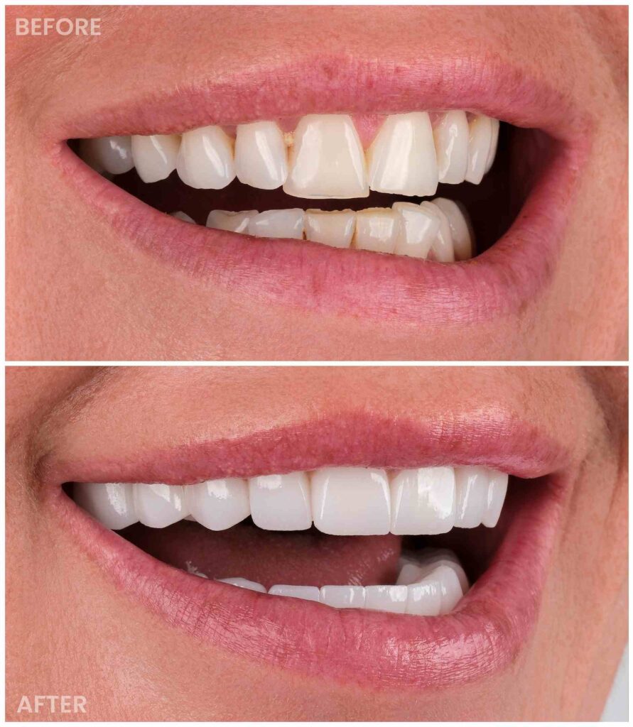dentist before after
