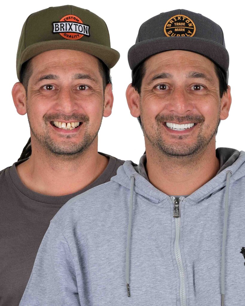 Before & After Gallery