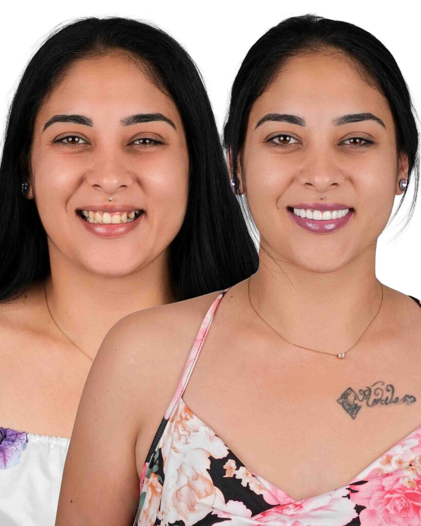 Before & After Gallery