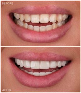 dentist before after