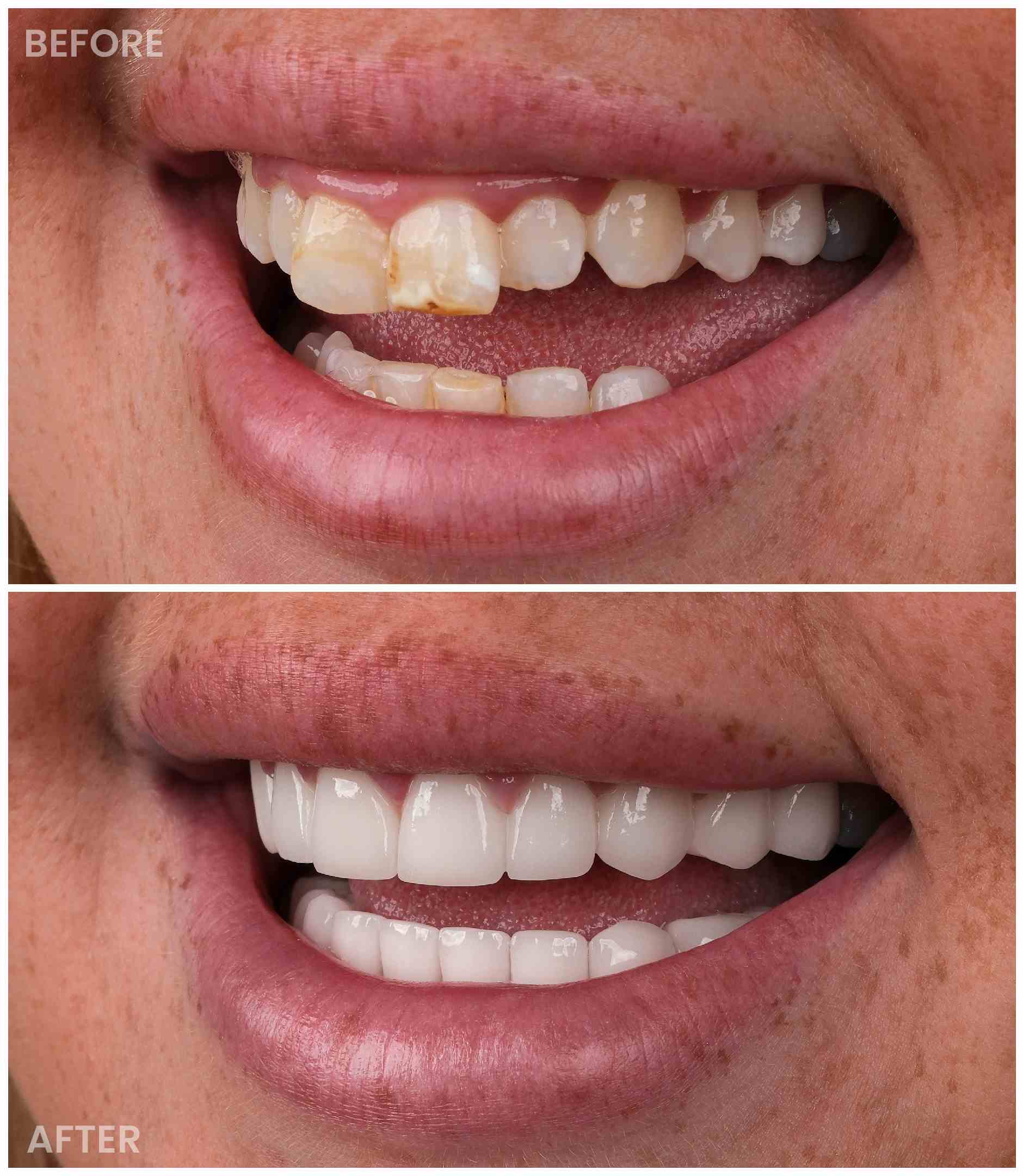 dentist before after