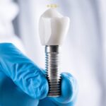 Dental Implants in Turkey