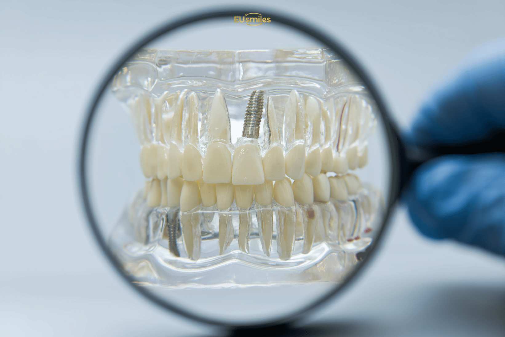 Турция и циркониевые коронки: сравнение для эстонцев