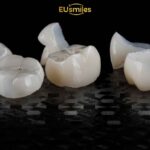 Zirconia vs Porcelain Crowns: What Latvians Should Choose