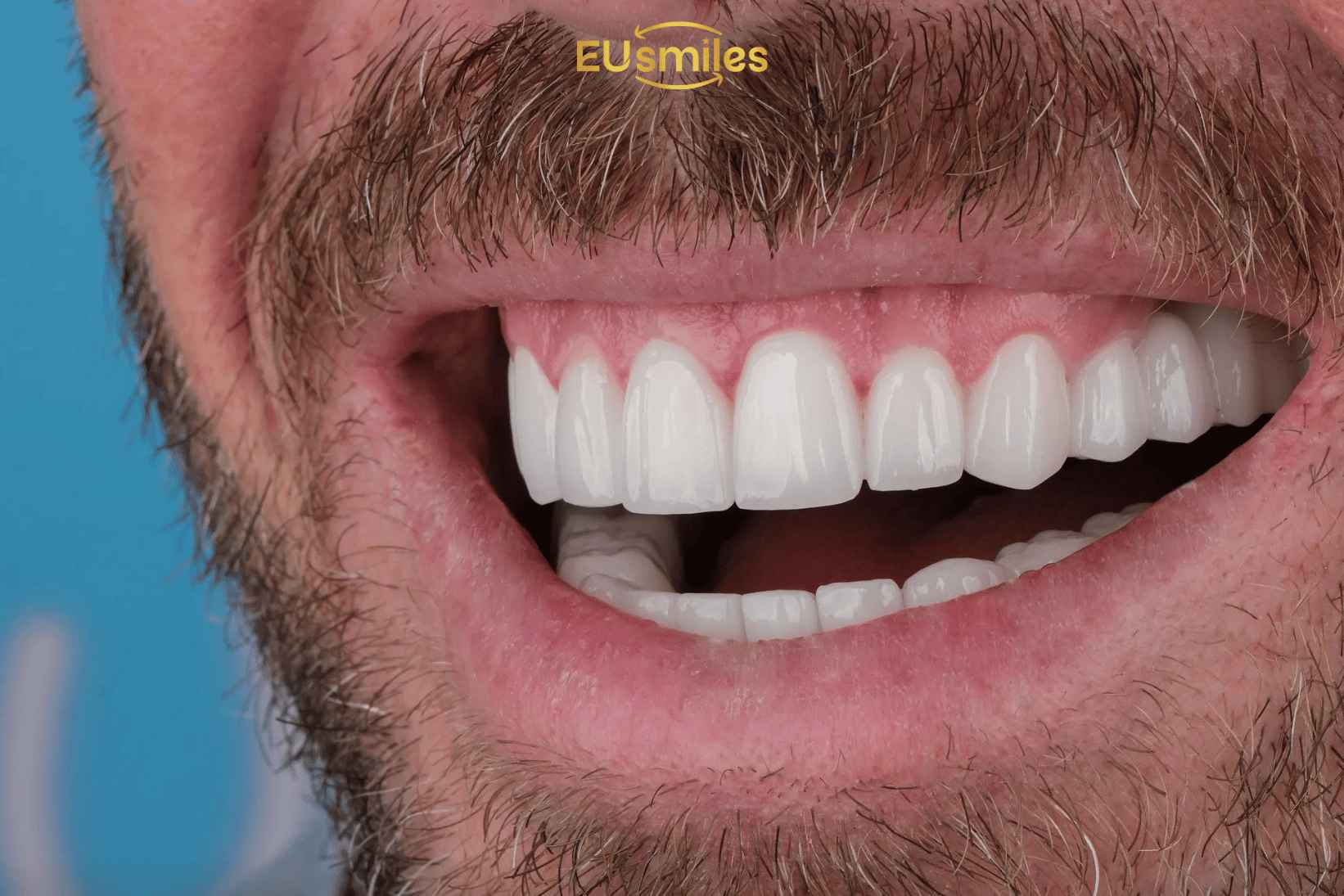 Before & After Dental Implant Results for Latvian Patients