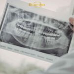 лучшая зубная клиника в таллинне