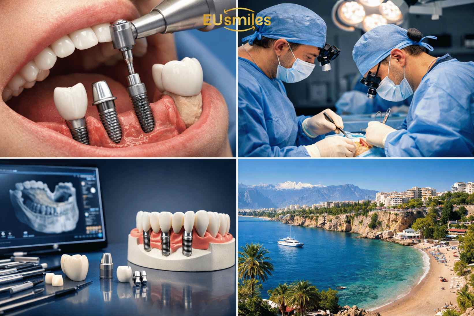 Jaw Surgery & Dental Implants in Turkey