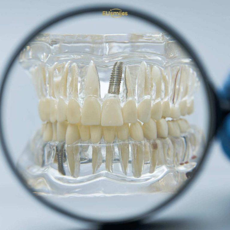 Turkey for Dental Implants