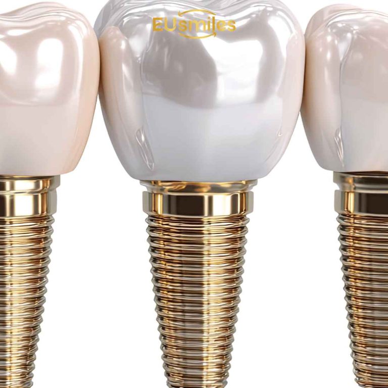 Full Mouth Dental Implants Turkey Cost