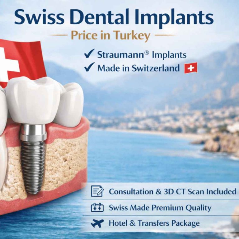 Swiss Dental Implants Price in Turkey