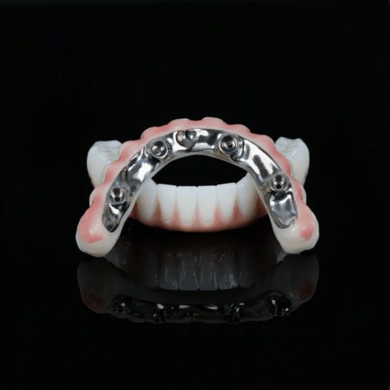 All-on-4 Dental Implants