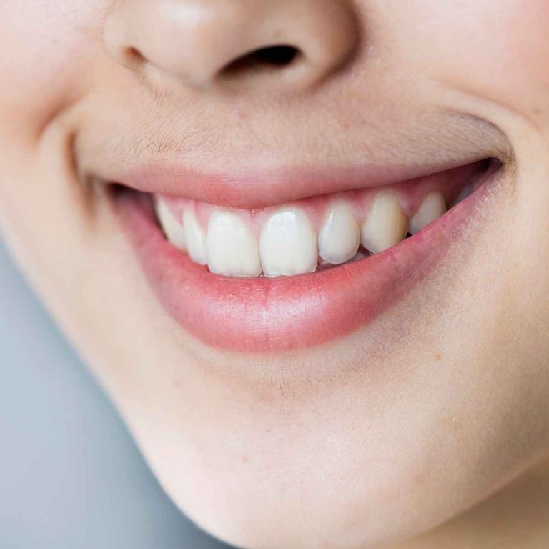 Cheaper to Get Your Teeth Done