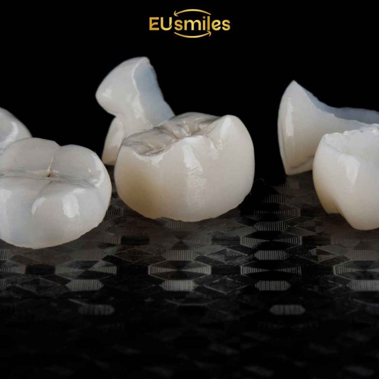 Zirconia vs Porcelain Crowns: What Latvians Should Choose