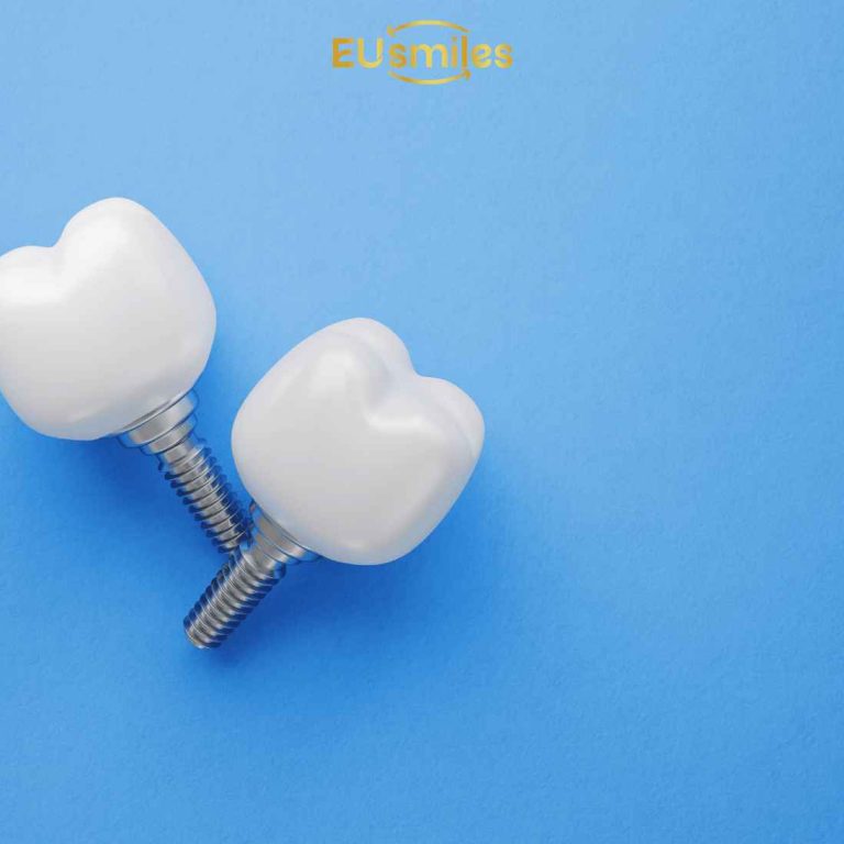 Dental Implants Recovery Time: What Latvians Should Expect