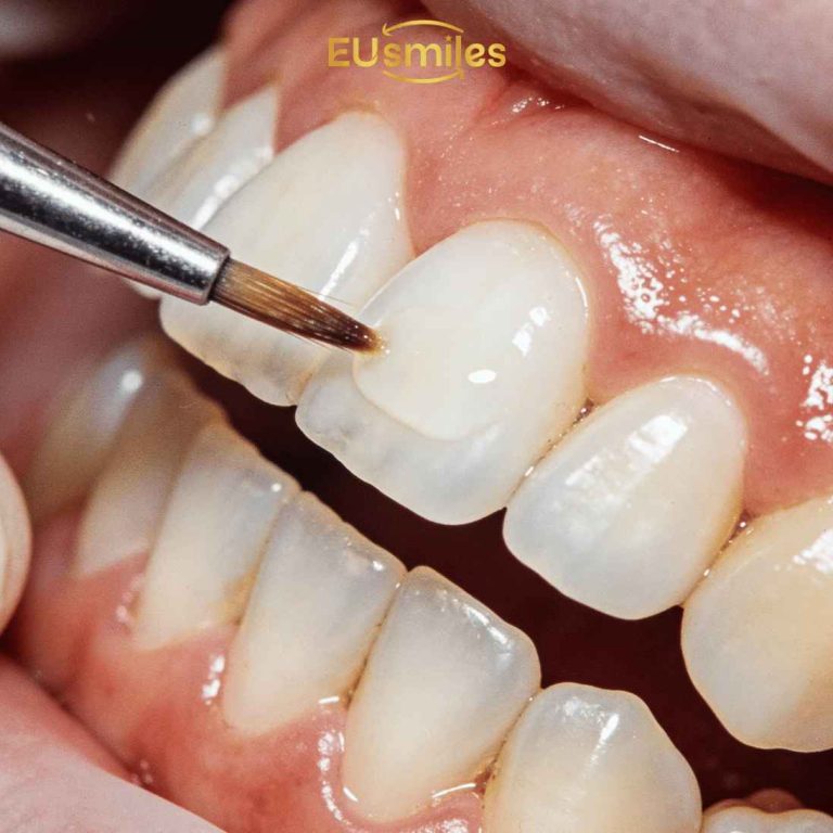 Dental Treatment Packages in Turkey for Latvian Patients