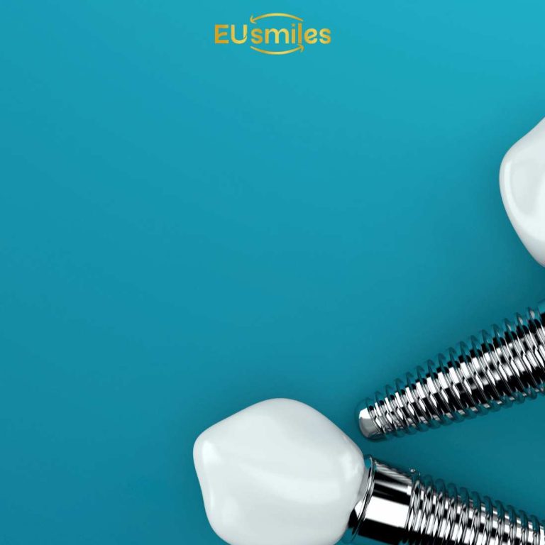 All-on-4 Dental Implants