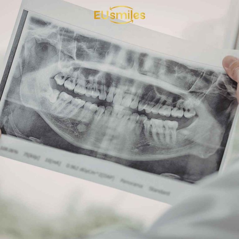 лучшая зубная клиника в таллинне